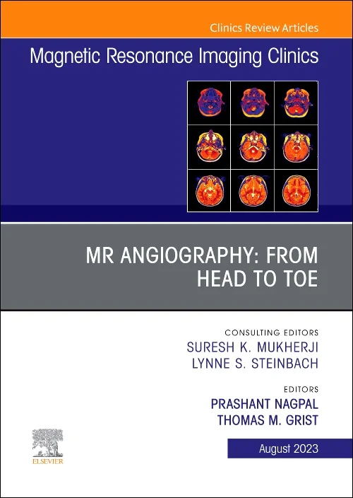 MR Angiography: From Head to Toe, An Issue of Magn...