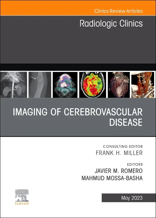 Imaging of Cerebrovascular Disease, An Issue of Ra...