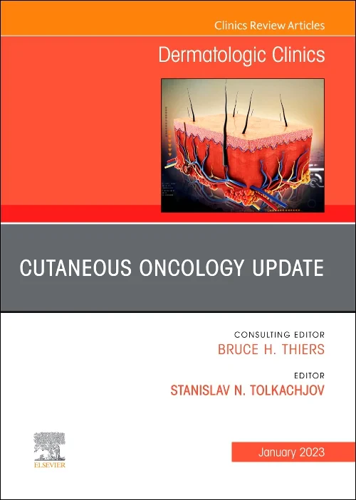 Cutaneous Oncology Update, An Issue of Dermatologi...