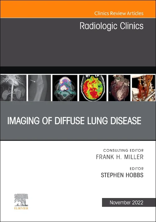 Imaging of Diffuse Lung Disease, An Issue of Radio...