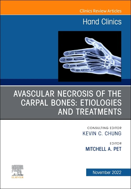 Avascular Necrosis of the Carpal Bones: Etiologies...