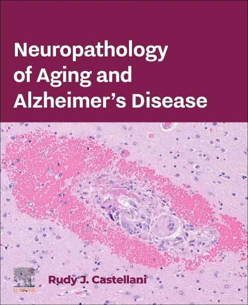 Neuropathology of Aging and Alzheimer’s Disease