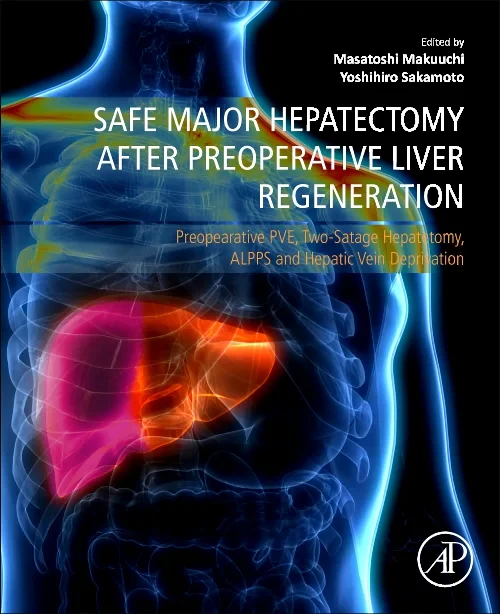 Safe Major Hepatectomy after Preoperative Liver Re...