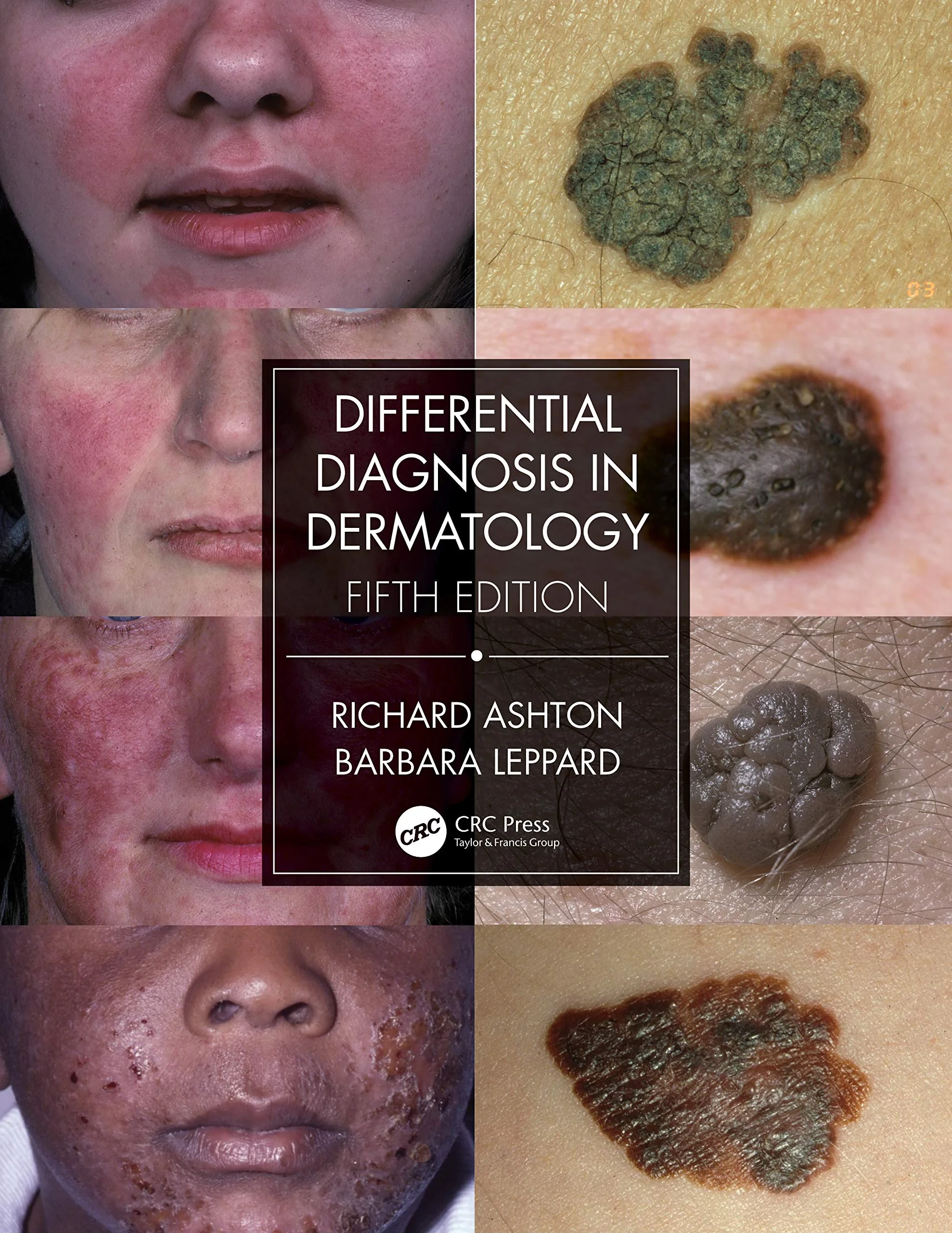 Coperta cărții "Differential Diagnosis in Dermatology" de autor necunoscut