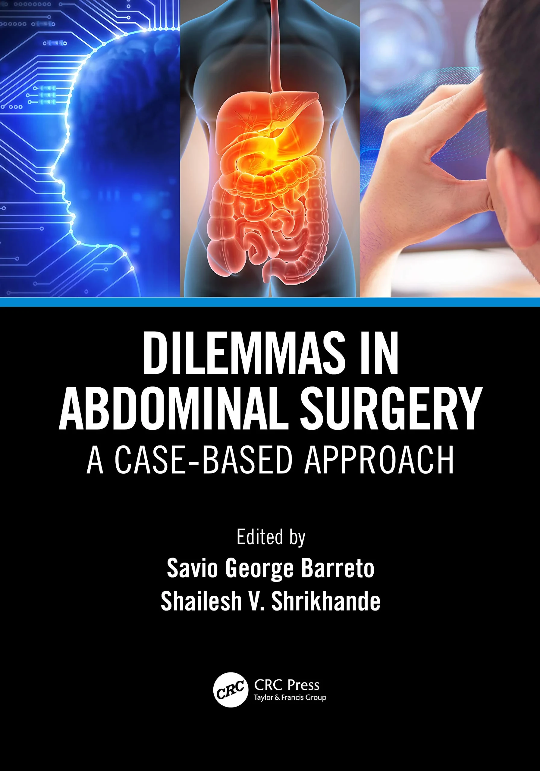 Coperta cărții "Dilemmas in Abdominal Surgery: A Case-Based Approach" de autor necunoscut