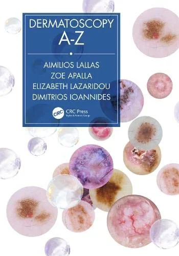 Coperta cărții "Dermatoscopy A-Z" de autor necunoscut