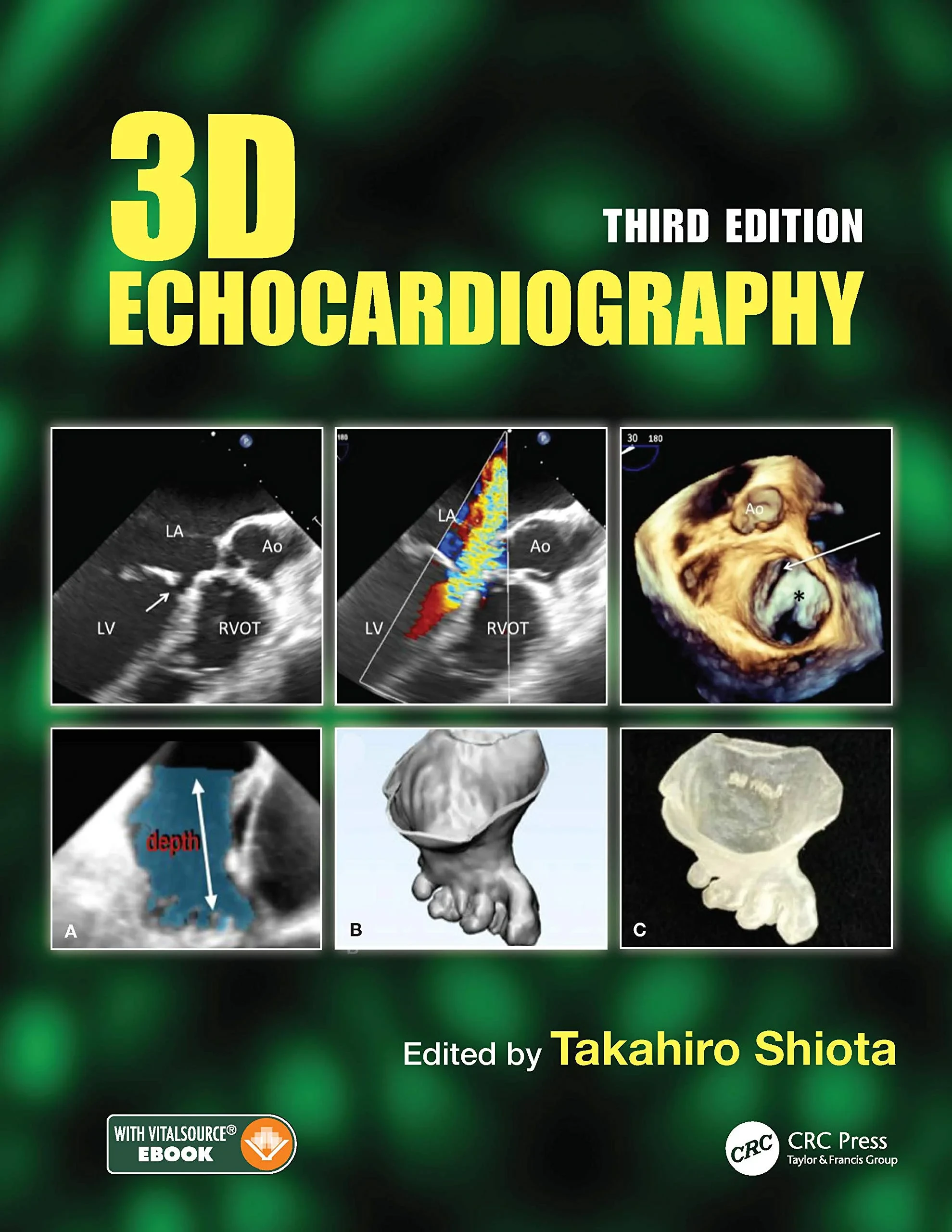 Coperta cărții "3D Echocardiography, 3rd Edition" de autor necunoscut