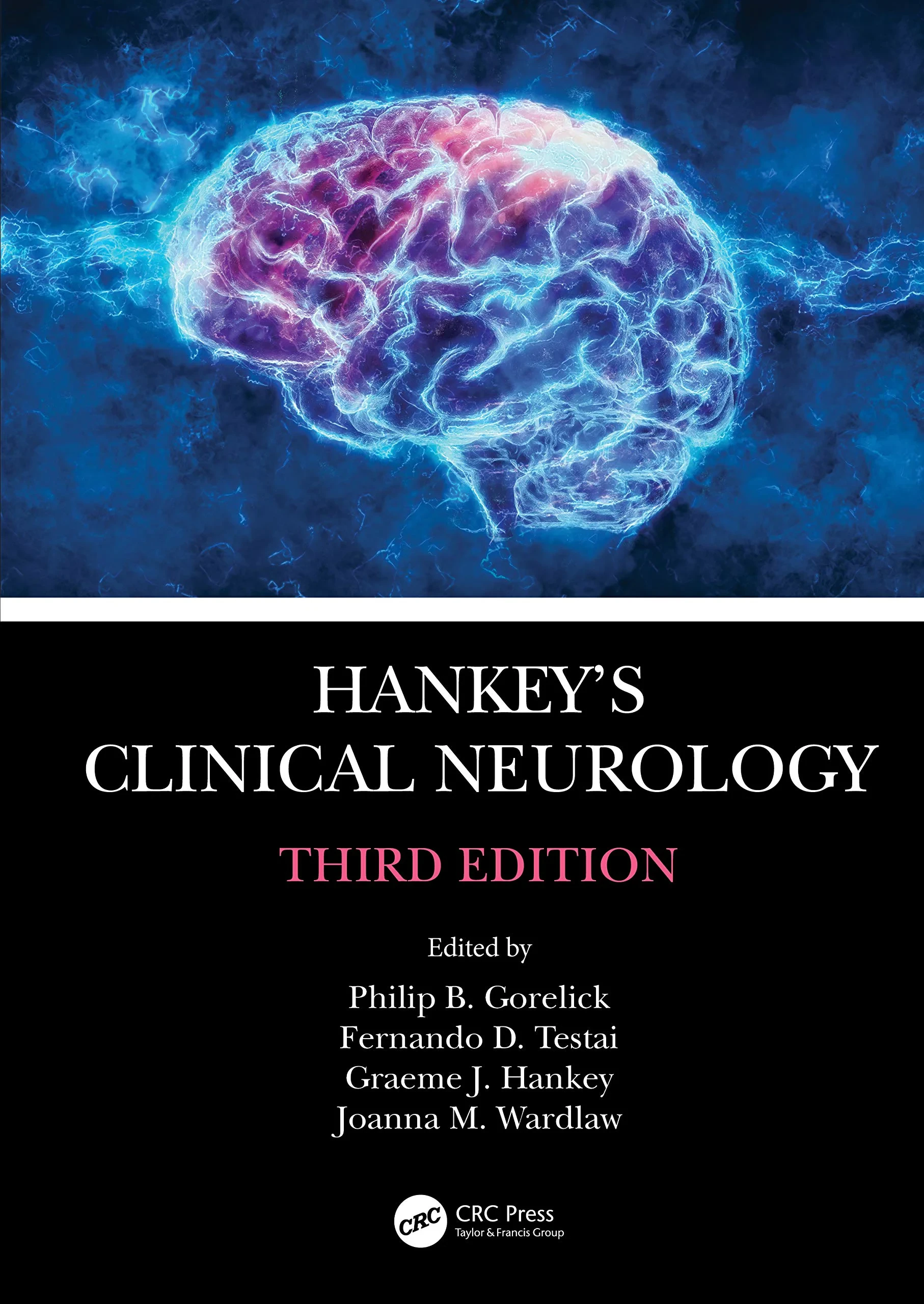 Coperta cărții "Hankey&amp;#146;s Clinical Neurology" de autor necunoscut
