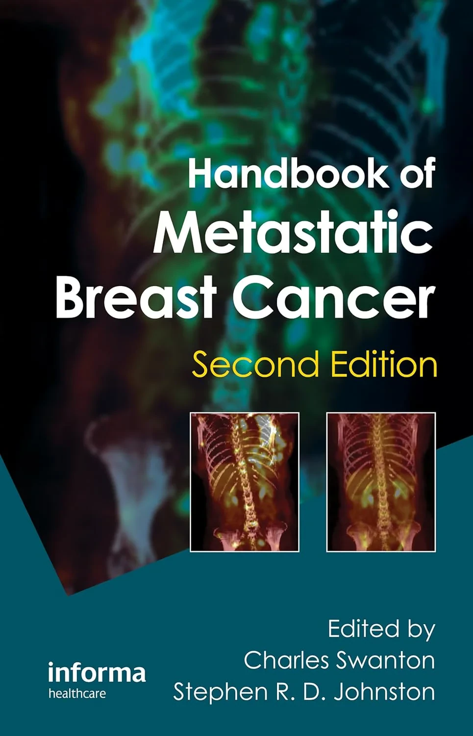 Coperta cărții "Handbook of Metastatic Breast Cancer" de autor necunoscut