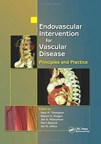 Coperta cărții "Endovascular Intervention for Vascular Disease" de autor necunoscut