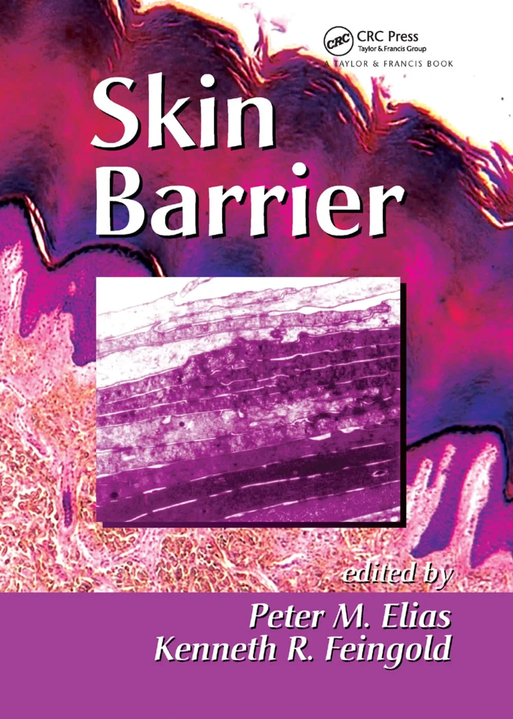 Coperta cărții "Skin Barrier" de autor necunoscut