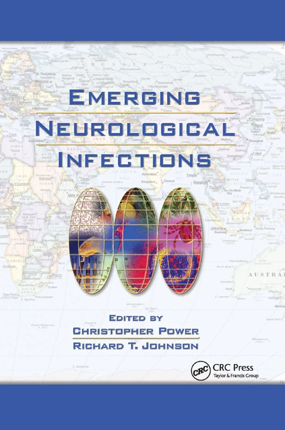 Coperta cărții "Emerging Neurological Infections" de autor necunoscut