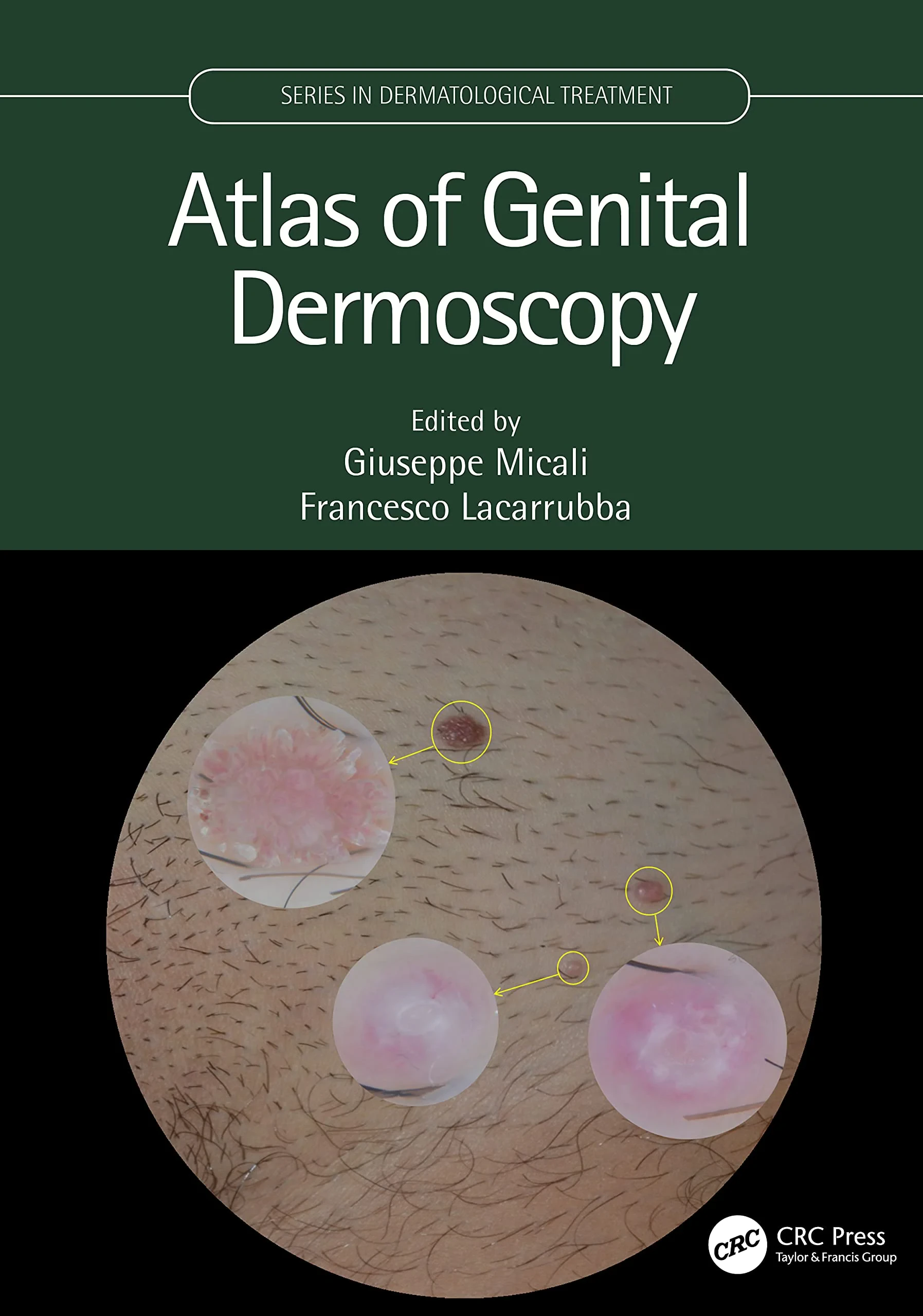 Coperta cărții "Atlas of Genital Dermoscopy" de autor necunoscut