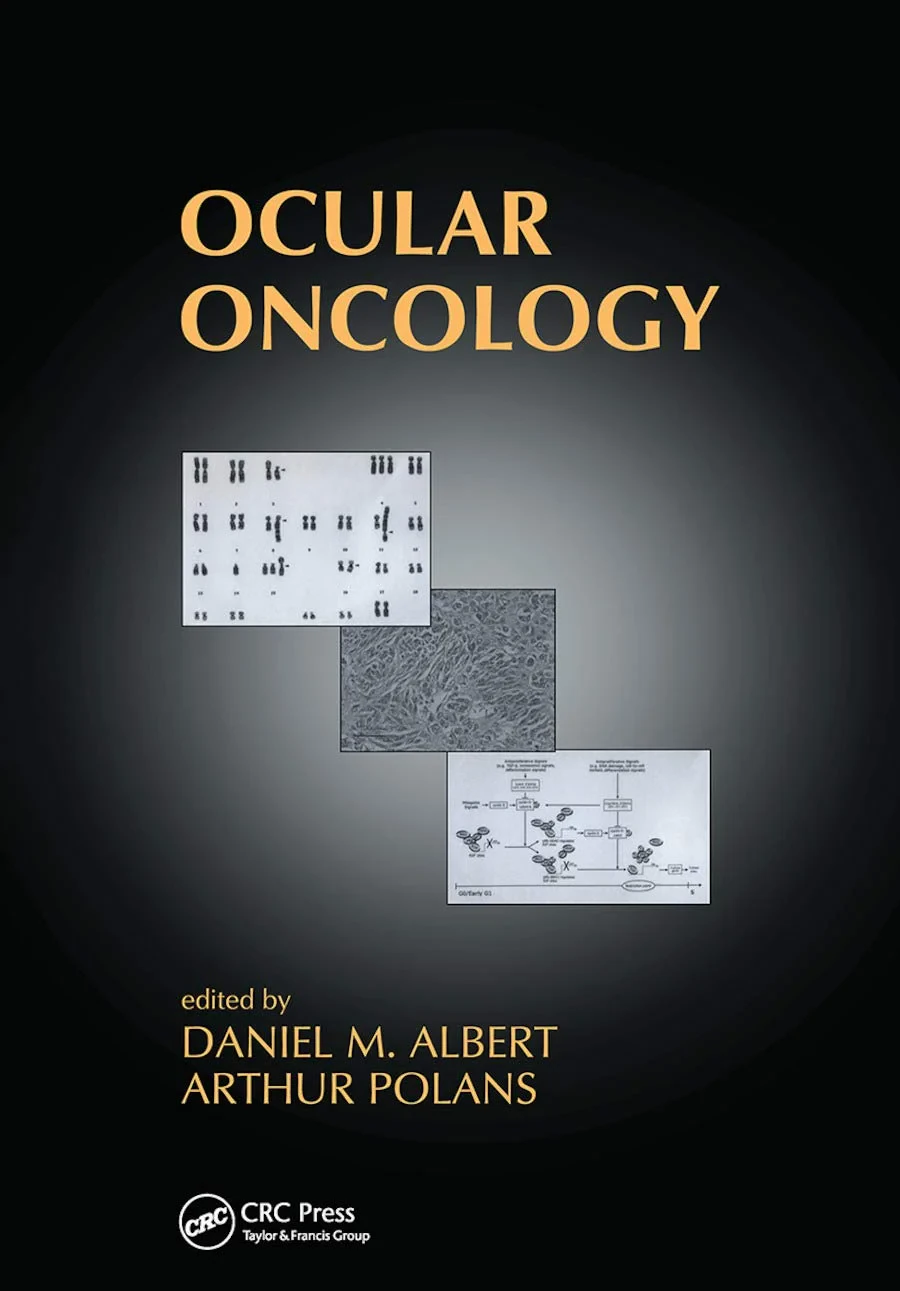 Coperta cărții "Ocular Oncology" de autor necunoscut