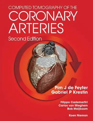 Coperta cărții "Computed Tomography of the Coronary Arteries" de autor necunoscut