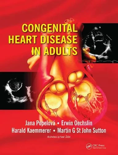 Coperta cărții "Congenital Heart Disease in Adults, 1st Edition" de autor necunoscut