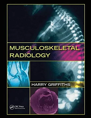 Coperta cărții "Musculoskeletal Radiology" de autor necunoscut