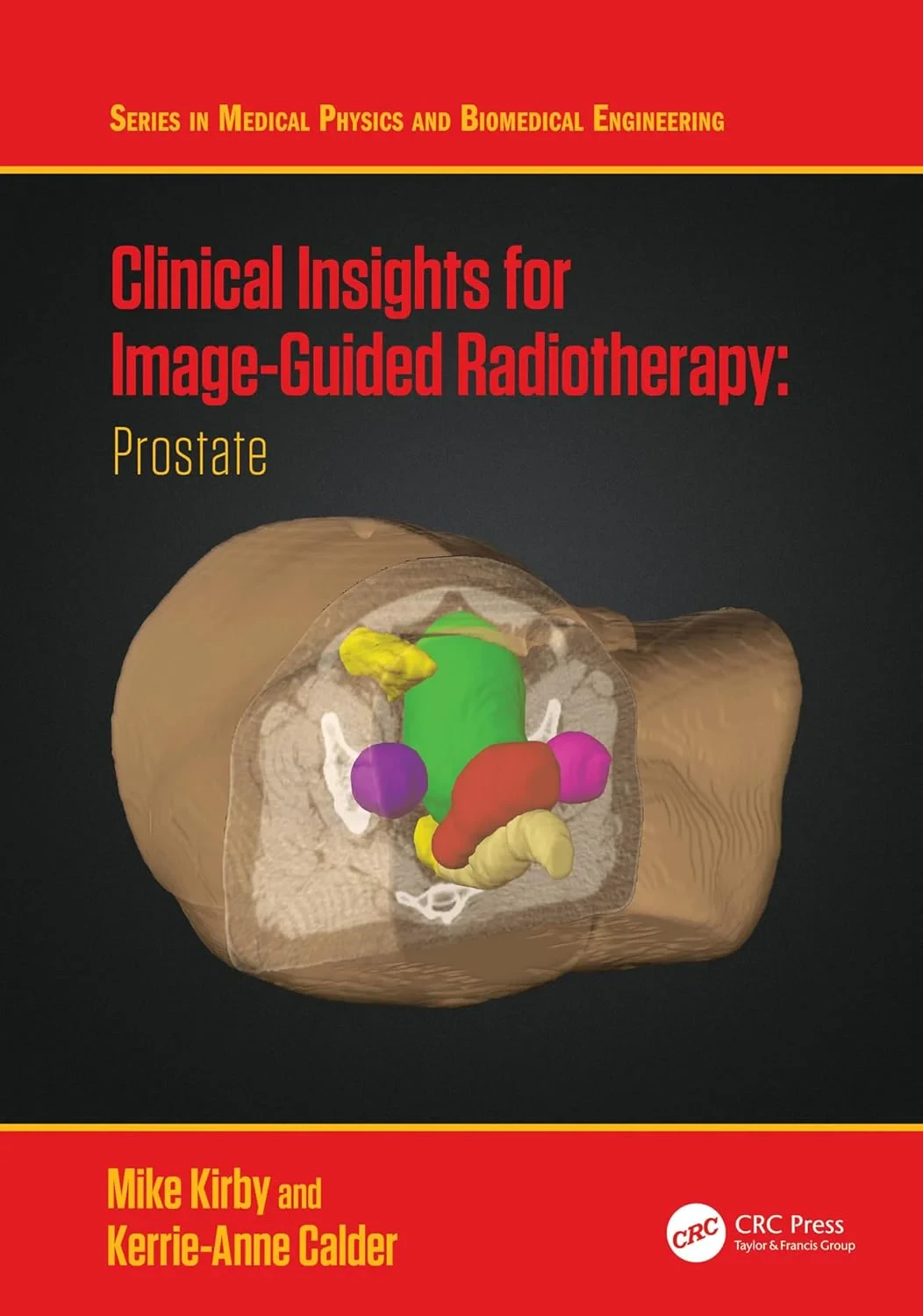 Coperta cărții "Clinical Insights for Image-Guided Radiotherapy: Prostate" de autor necunoscut