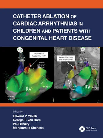 Coperta cărții "Catheter Ablation of Cardiac Arrhythmias in Children and Patients with Congenital Heart Disease" de autor necunoscut