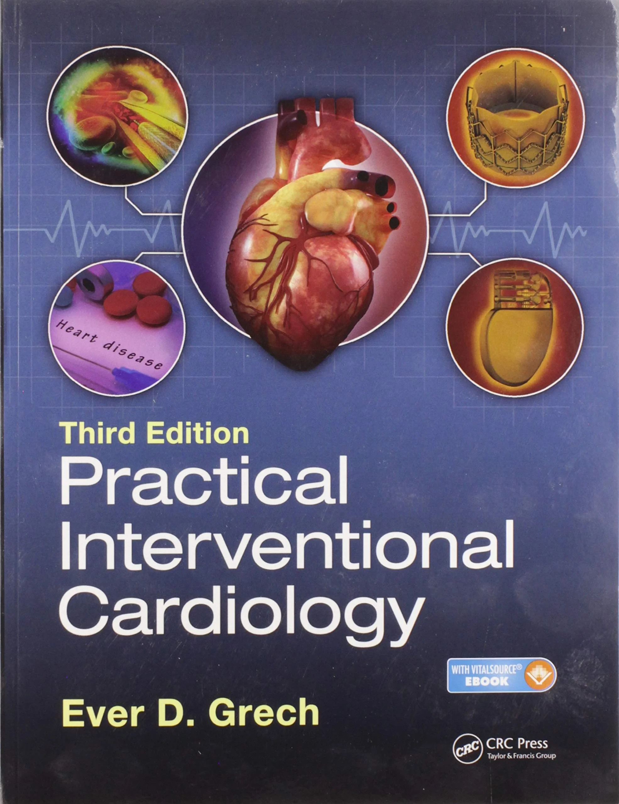 Coperta cărții "Practical Interventional Cardiology: Third Edition" de autor necunoscut