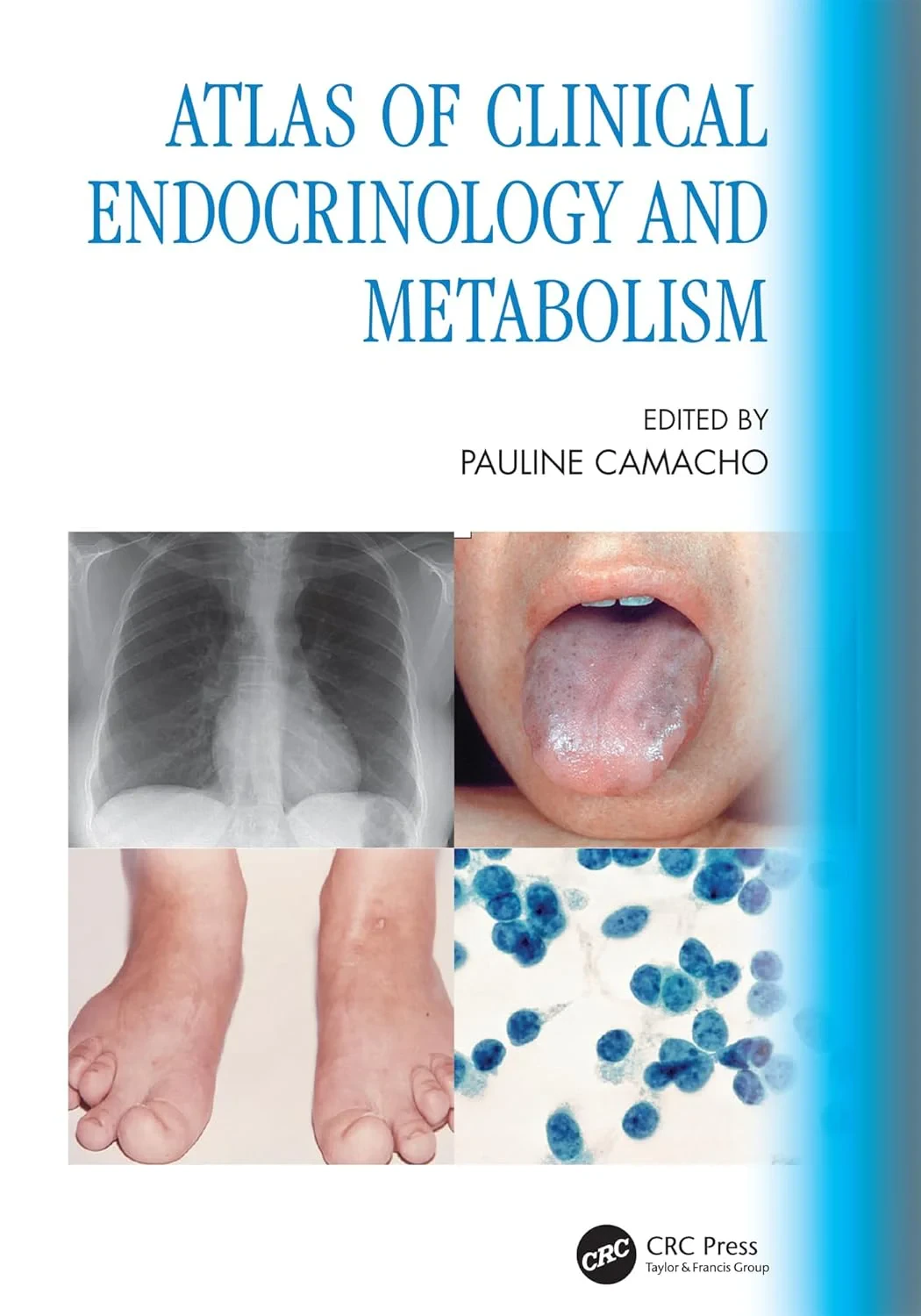 Coperta cărții "Atlas of Clinical Endocrinology and Metabolism" de autor necunoscut