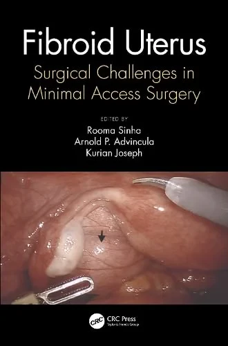Coperta cărții "Fibroid Uterus: Surgical Challenges in Minimal Access Surgery" de autor necunoscut