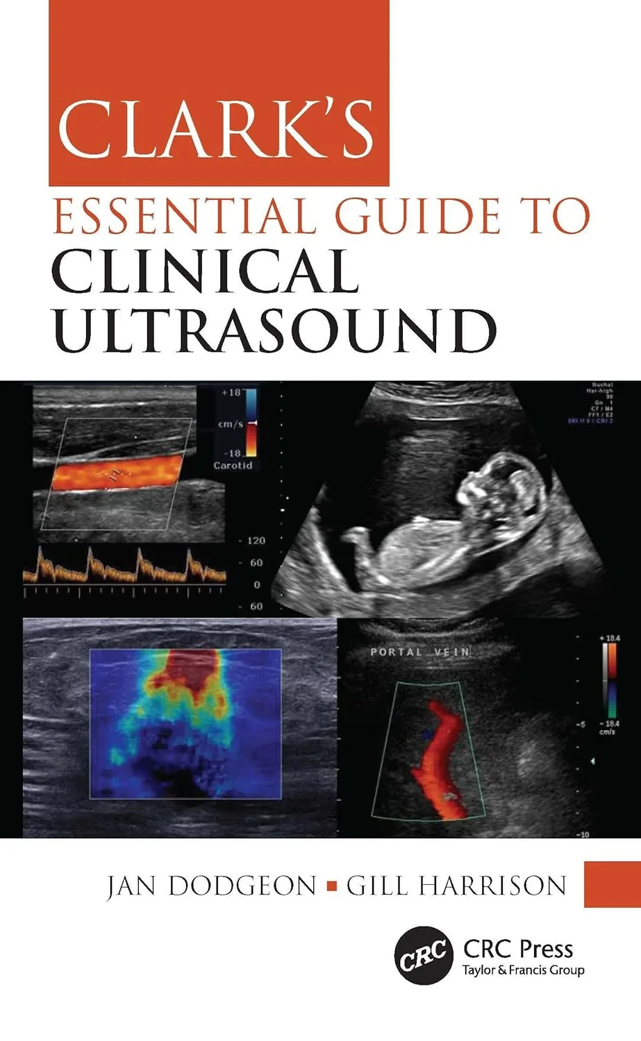 Coperta cărții "Clark&amp;#146;s Essential Guide to Clinical Ultrasound" de autor necunoscut