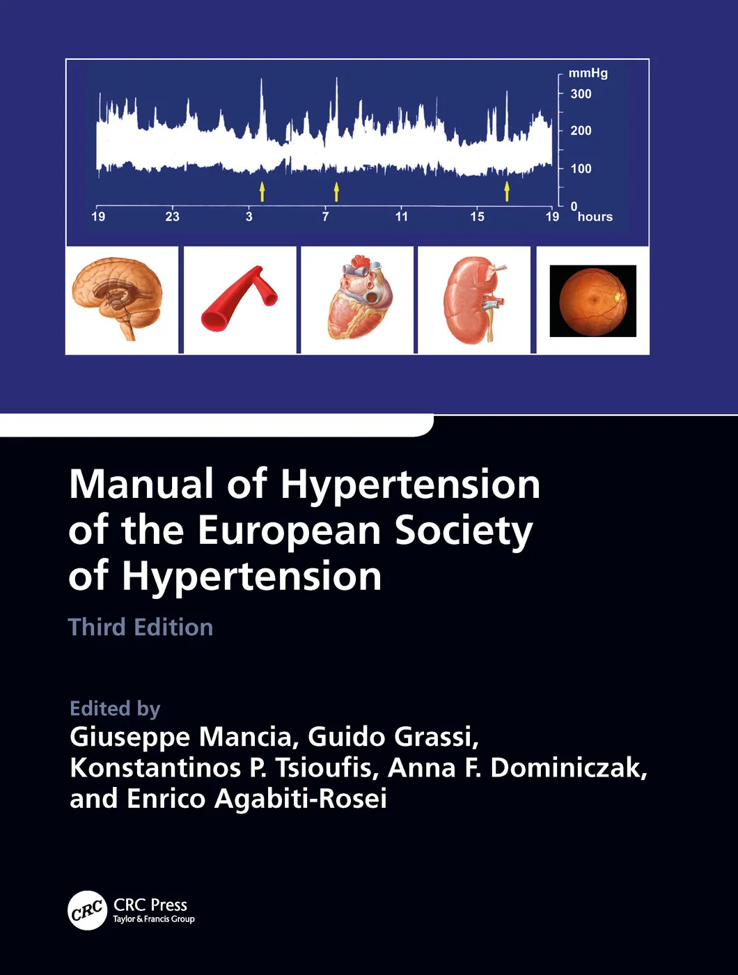 Coperta cărții "Manual of Hypertension of the European Society of Hypertension, Third Edition" de autor necunoscut