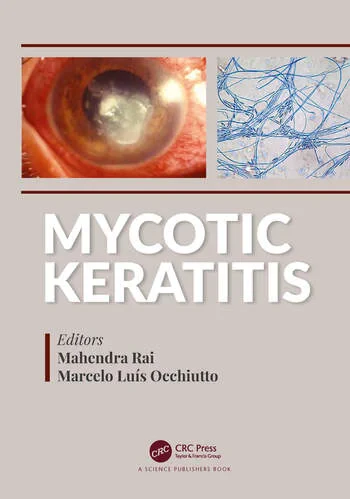 Coperta cărții "Mycotic Keratitis" de autor necunoscut