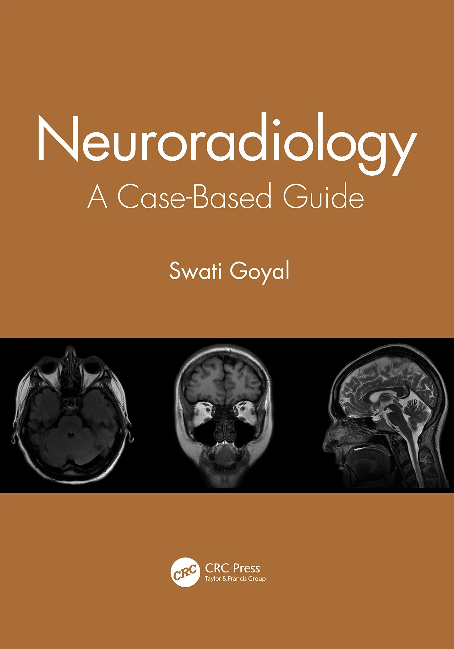 Coperta cărții "Neuroradiology: A Case-Based Guide" de autor necunoscut