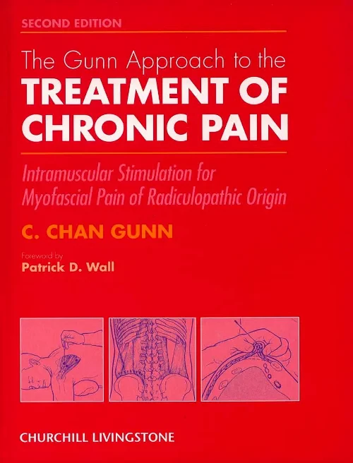 The Gunn Approach to the Treatment of Chronic Pain