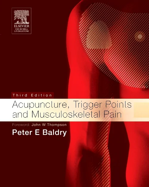 Acupuncture, Trigger Points and Musculoskeletal Pa...