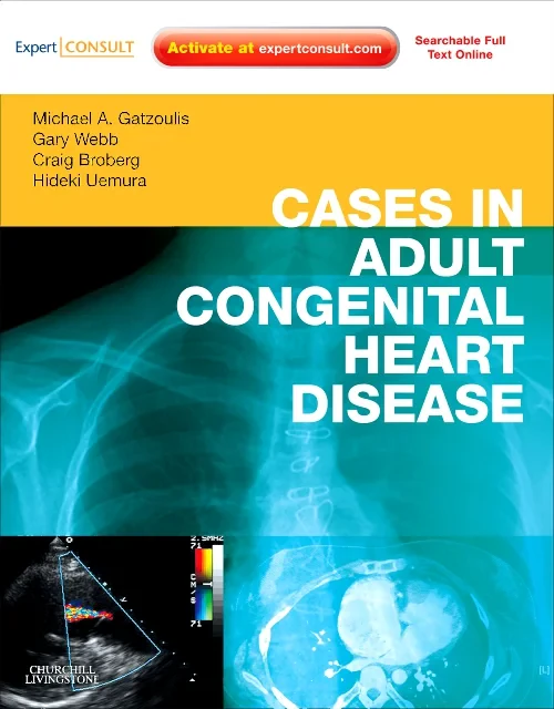 Cases in Adult Congenital Heart Disease - Expert C...