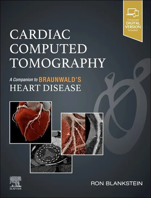 Cardiac Computed Tomography