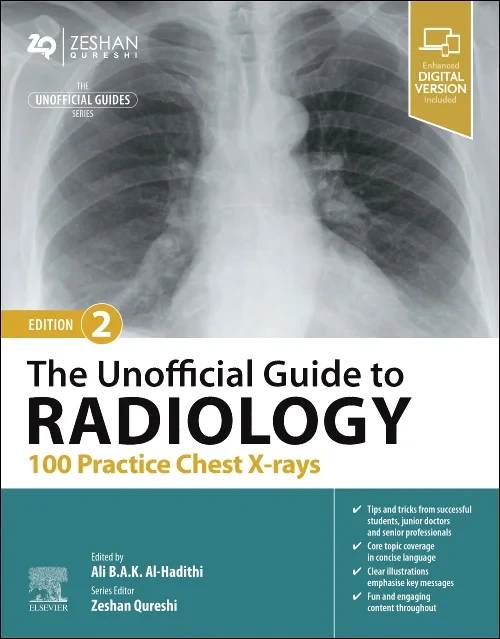 The Unofficial Guide to Radiology: 100 Practice Ch...