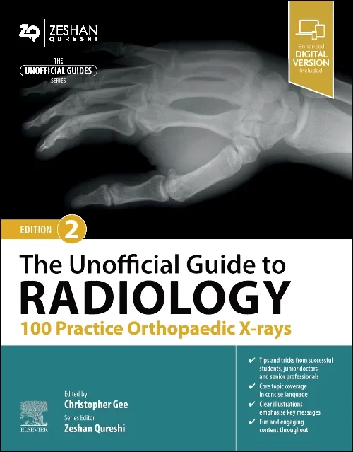 Coperta cărții "The Unofficial Guide to Radiology: 100 Practice Orthopaedic X-rays" de autor necunoscut