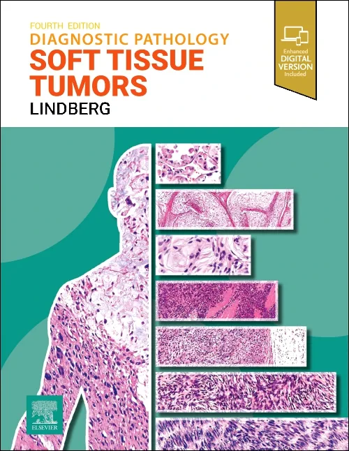 Coperta cărții "Diagnostic Pathology: Soft Tissue Tumors" de autor necunoscut