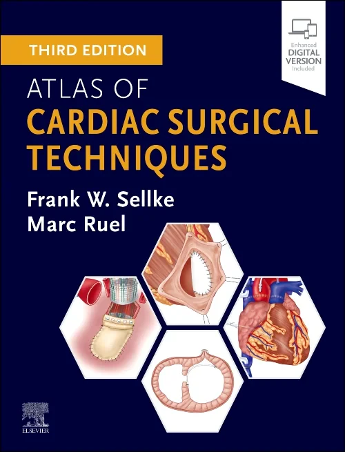 Coperta cărții "Atlas of Cardiac Surgical Techniques" de autor necunoscut