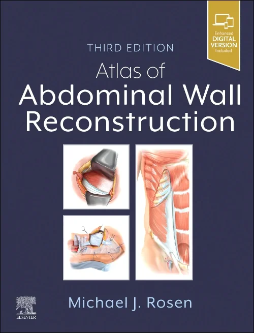 Atlas of Abdominal Wall Reconstruction
