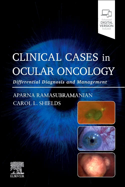 Coperta cărții "Clinical Cases in Ocular Oncology: Differential Diagnosis and Management" de autor necunoscut