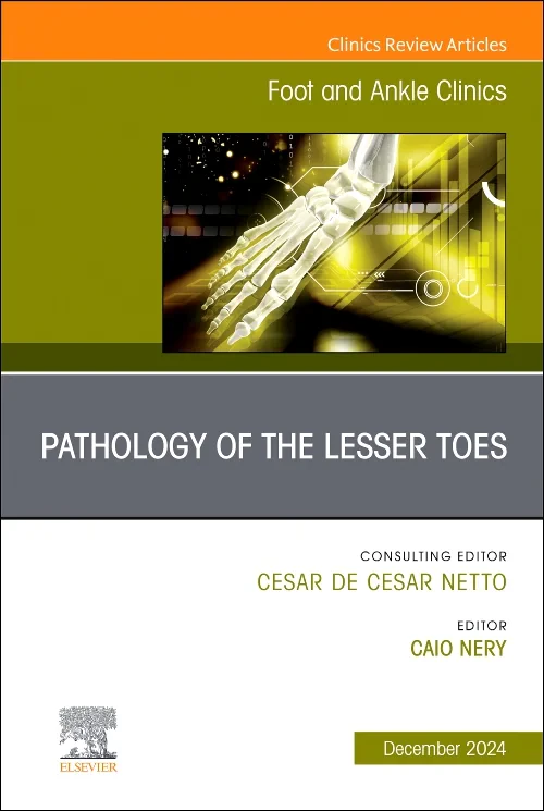 Pathology of the Lesser Toes, An issue of Foot and...