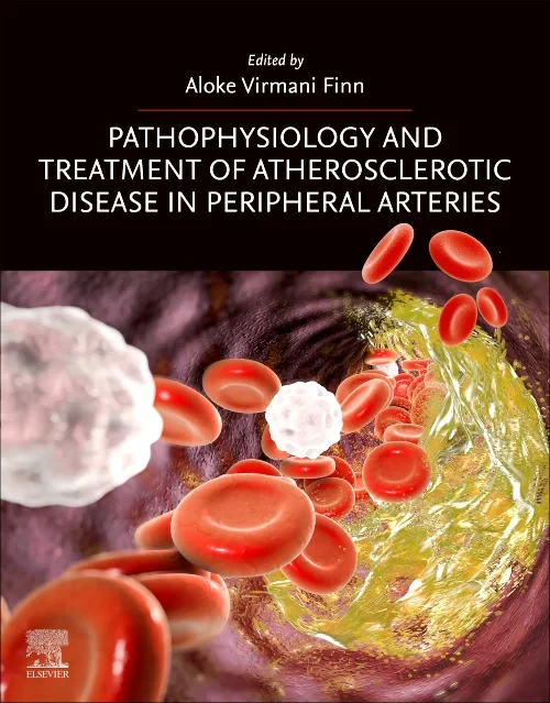 Pathophysiology and Treatment of Atherosclerotic D...