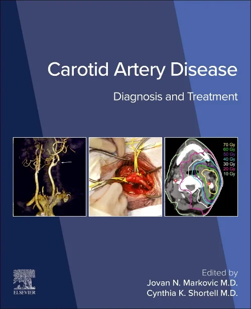 Carotid Artery Disease