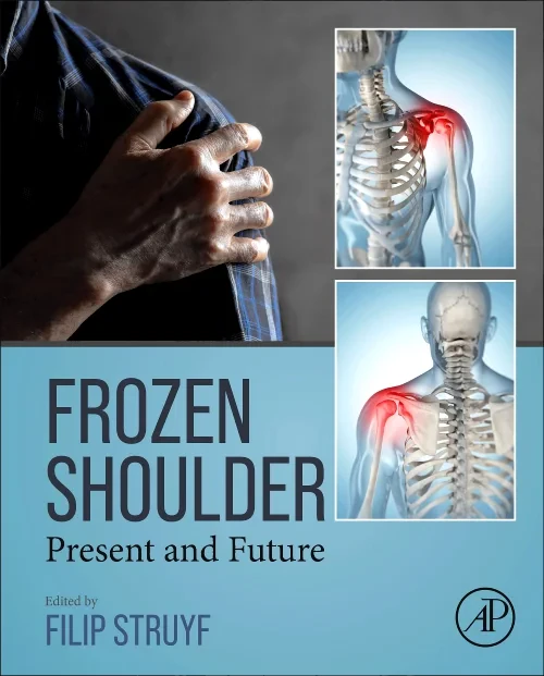 Frozen Shoulder
