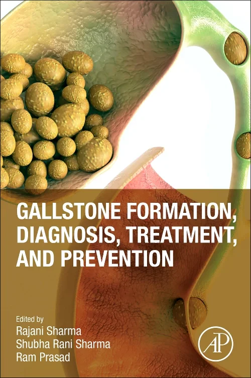 Gallstone Formation, Diagnosis, Treatment and Prev...