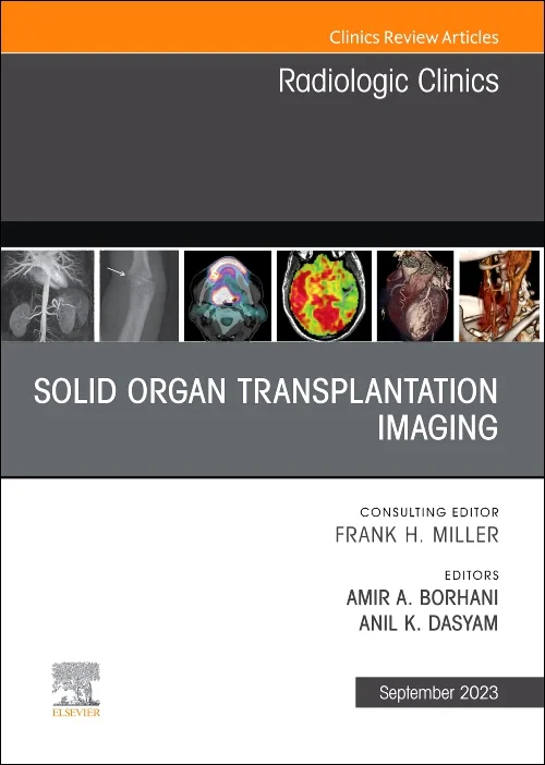 Solid Organ Transplantation Imaging, An Issue of R...