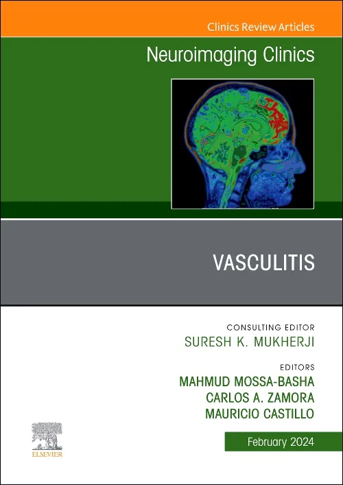 Vasculitis, An Issue of Neuroimaging Clinics of No...