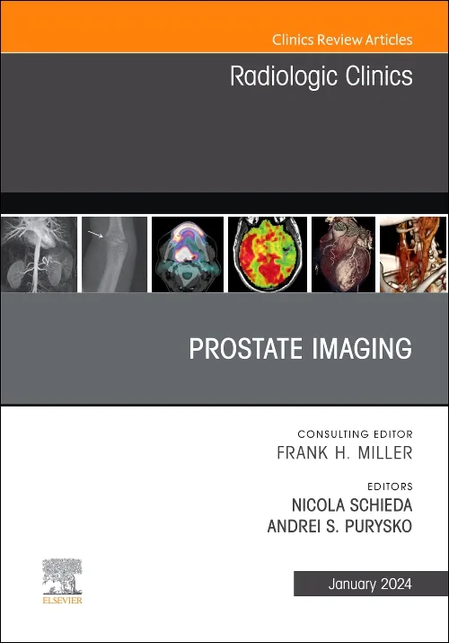 Prostate Imaging, An Issue of Radiologic Clinics o...