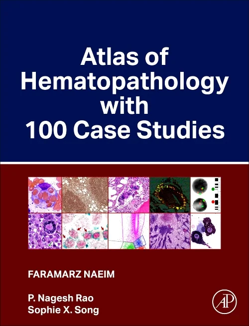 Coperta cărții "Atlas of Hematopathology with 100 Case Studies" de autor necunoscut