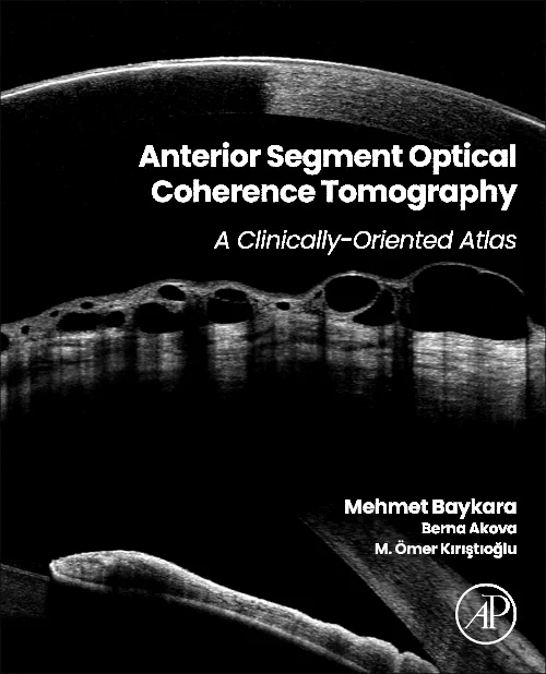 Anterior Segment Optical Coherence Tomography